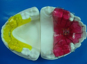 twin block